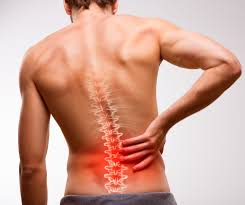 Back Pain Chiropractor in Lekki