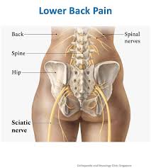Back Pain Chiropractor in Lekki