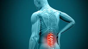 Do I Have a Slipped Disc?