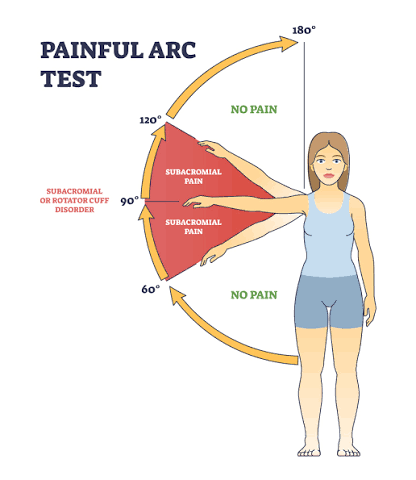 Rotator Cuff Tear Treatment in Lagos