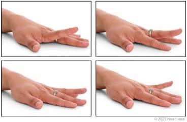 Wrist Fracture Treatment in Lagos