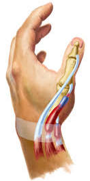 De Quervain's Tenosynovitis Treatment in Lagos