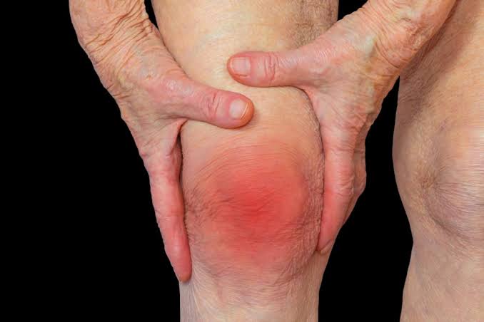 Book Arthritis Treatment in Lagos
